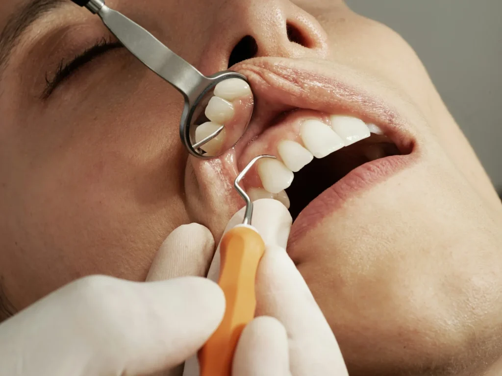 Periodontal maintenance in Brampton at Brampton Dental Care